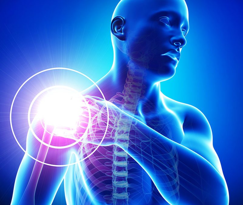 Descompresión subacromial y el dolor de hombro