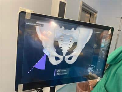 traumatologo-especialista-dolor-cadera-granada-clinica-martin-gomez