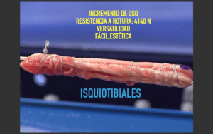 Isquiotibiliales