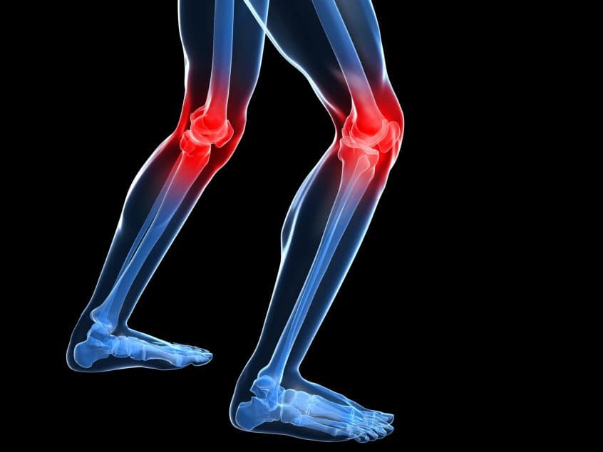 Girar dolor rodilla hacia la dentro al