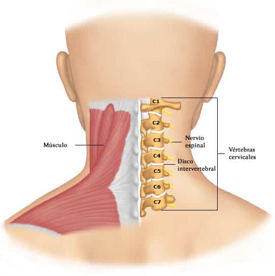 Qué Es El Latigazo Cervical Y Cómo Se Trata Clínica Martín Gómez 6293