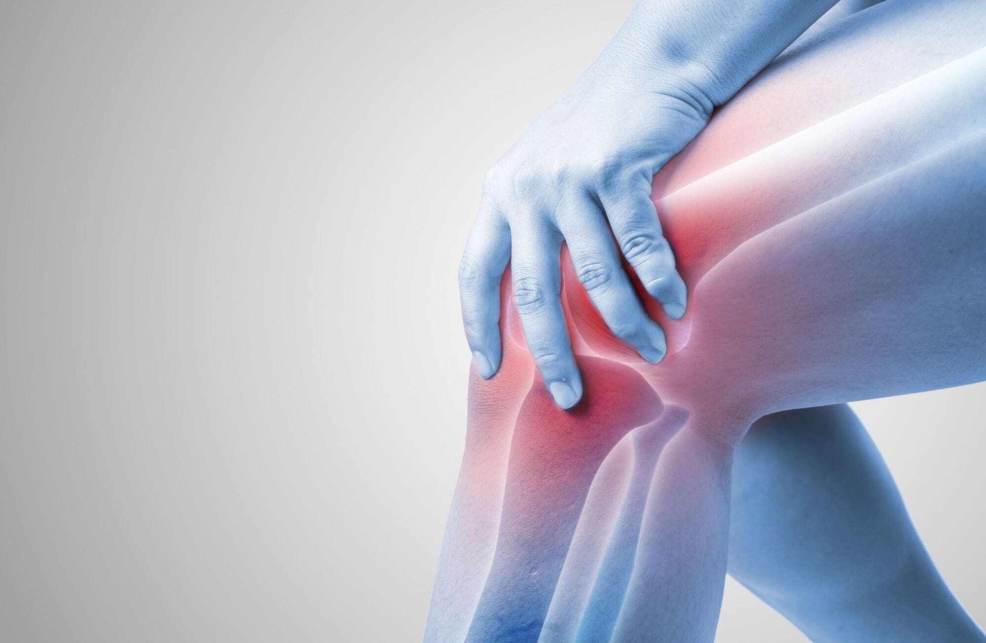  Fractura de Segond: Una lesión específica de la rodilla que no debe pasar desapercibida
