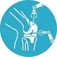 Cirugía Robotica de Rodilla en Granada Clinica Martin Gomez