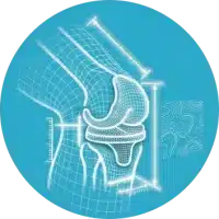 Cirugía de Rodilla 3D personalizada en Granada Clinica Martin Gomez